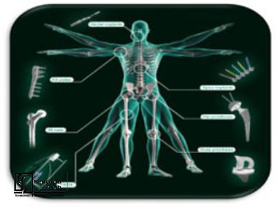 Technical, Financial Feasibility Study and Planning Justification Report of Establishing production Unit of orthopedic implants and internal bone fixators